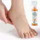 Generic Foot Peeling Spray 110ml Orange Foot Exfoliating Oil Moisturizing Nourishes and removes dead skin from feet in seconds. Natural orange essence for pedicure, hand cosmetics, moisturizing, nourishing, exfoliating. | Veela Beauty Generic Foot Peeling Spray 110ml | فييلا بيوتي